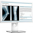 [해외]Dell Medical Review 21.5&quot; Edge LED LCD 모니터 - 16:9 - 14 ms