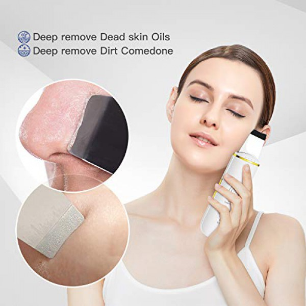 [해외] GUGUG 모공클리너 팁클렌징 스킨 스크러버 GUGUG Skin Scrubber - Skin Spatula, Blackhead Remover Pore Cleaner with 4 Modes, Facial Scrubber Spatula, Comedones Extractor for Facial Deep Cleansing